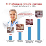 ESENCIA DE REPARACIÓN DE UÑAS LANBENA